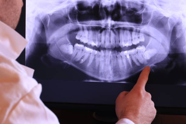Best Emergency Treatment for Jaw Pain or Injury in Sugarmill Woods, FL